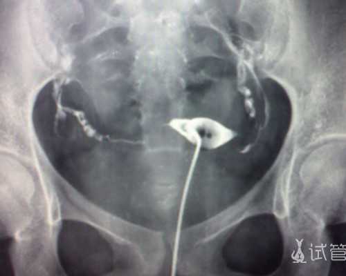 自然受孕代妈_找代妈找泰孕健康_做深圳助孕试管婴儿影响成功率的因素是什么