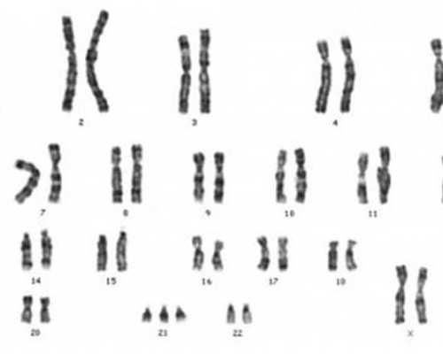 输卵管介入疏通术优势有哪些