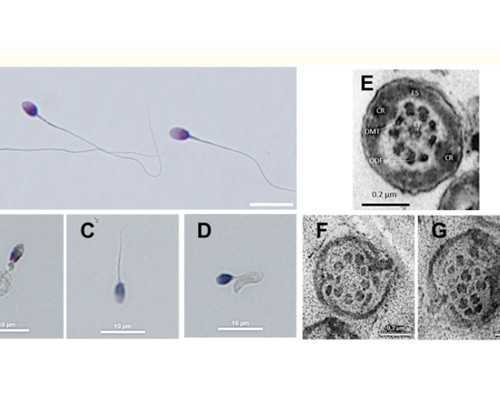 真心寻找2020年合作自然代妈_助孕输卵管堵塞有什么症状？