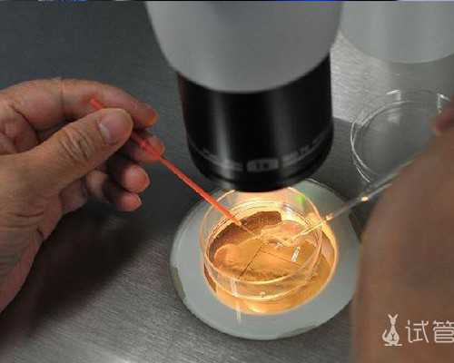 孕初期一招看男女小技巧，分泌物、b超、症状立见分晓