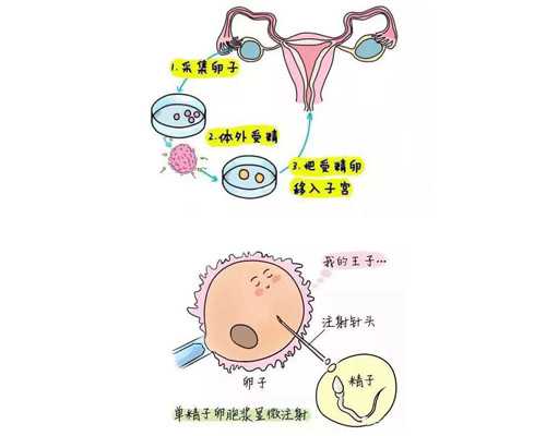 助孕世纪代妈_国庆好孕“不打烊” 梦美生命美国试管婴儿助孕顾问就在您身边