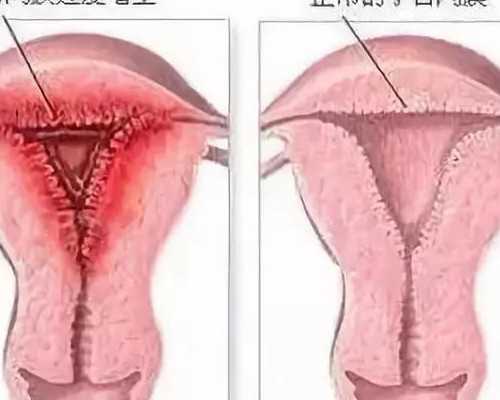 找试管婴儿代妈_自然代妈是怎么回事_在甘肃张掖做助孕试管婴儿的成功率高不