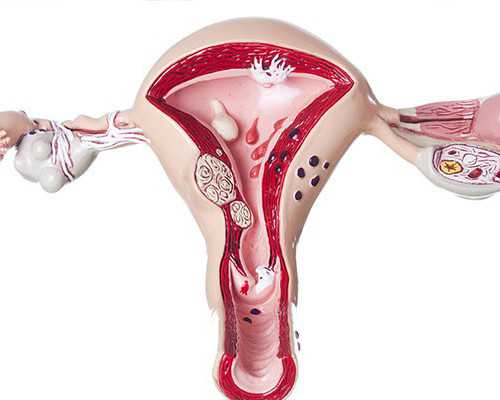 专业代妈价格_[曲靖试管婴儿]试管婴儿助孕需要准备什么