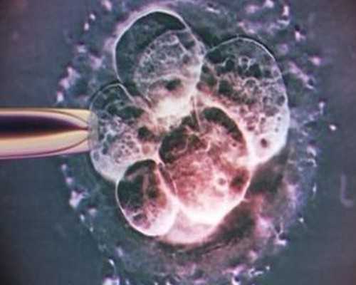 多囊卵巢可做试管婴儿吗？怎么提高成功率呢！