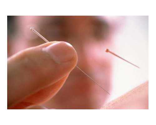 找的代妈_找代妈找泰孕健康_了解会阴侧切 帮助孕妇解除恐惧