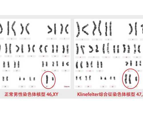 正规代妈要求_中介怎么骗代妈_不明原因不孕症能做郑州助孕试管婴儿吗？