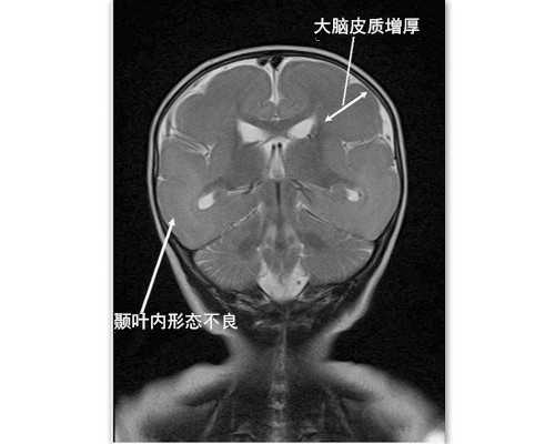 找自然受孕代妈价格_哪些食物能够助孕，适合备孕的人群吃？